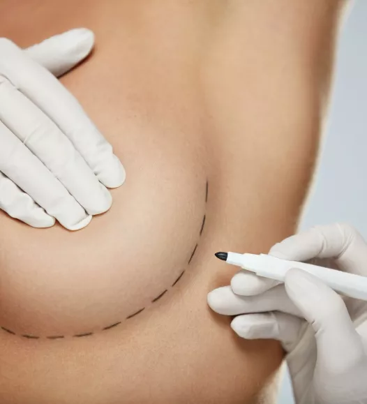 Borstcorrecties behandelingen bij de Helene Schweitzer kliniek. Borstvergroting, borstlift, borstverkleining.