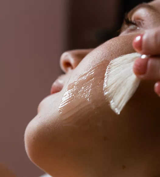 Vrouw krijgt chemische peeling tegen rimpels, onregelmatigheden en pigmentafwijking. In te plannen bij de Helene Schweitzer kliniek.