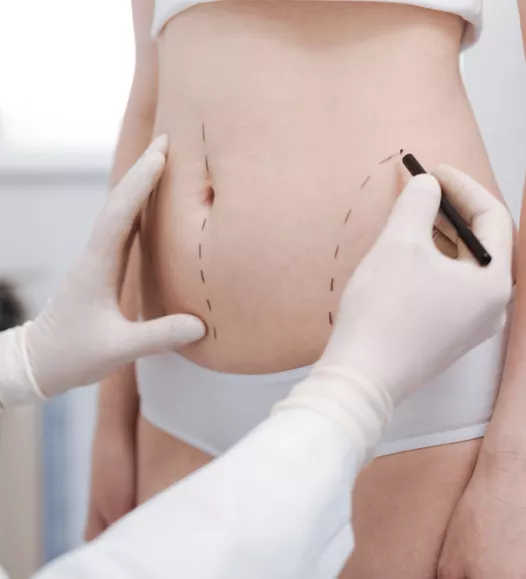 Abnormale vethoping? Met een liposuctie bij de Helene Schweitzer kliniek kan dit behandeld worden.