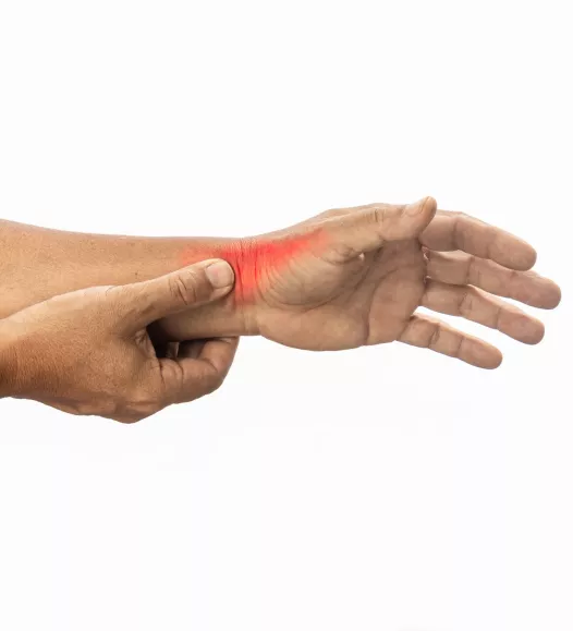 Slijtage duimbasis (artrose) - zwelling aan de duimbasis. Te behandelen bij de Helene Schweitzer kliniek.