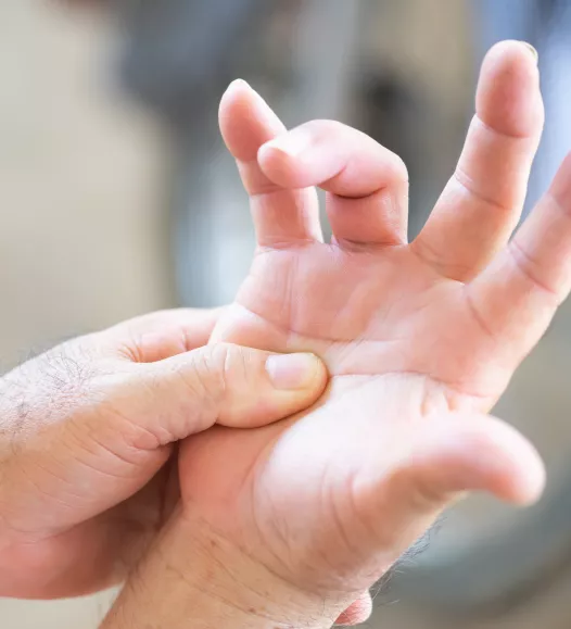 Triggerfinger (haperende vinger) - moeite met strekken. Behandelbaar bij de Helene Schweitzer kliniek.