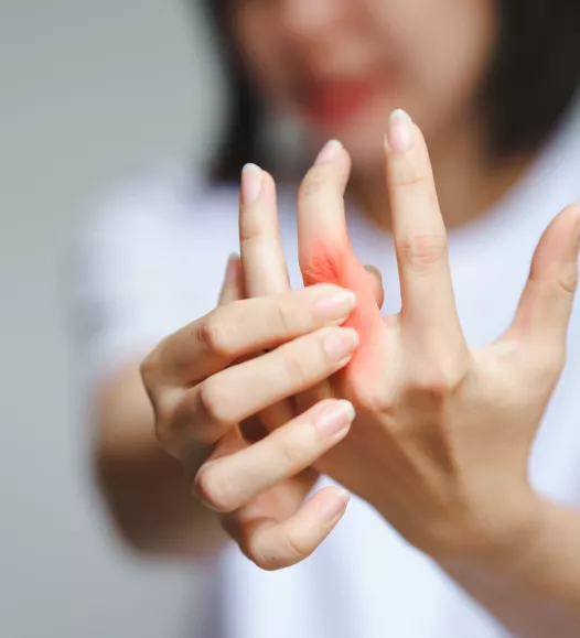 Slijtage in het PIP- of MCP-gewricht. Te behandelen met een vingergewrichtsprothese bij de Helene Schweitzer kliniek.